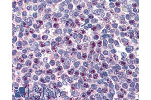 Immunohistochemistry (IHC) image for anti-Forkhead Box C1 (FOXC1) (C-Term) antibody (ABIN185028)