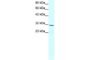 Human Jurkat; WB Suggested Anti-CLDN17 Antibody Titration: 2. (Claudin 17 Antikörper  (Middle Region))