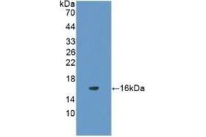 FSHB anticorps  (AA 21-130)