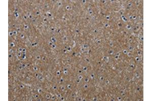 The image on the left is immunohistochemistry of paraffin-embedded Human brain tissue using ABIN7129632(GNG2 Antibody) at dilution 1/60, on the right is treated with fusion protein. (GNG2 Antikörper)