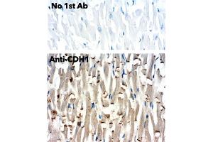 Immunohistochemistry (IHC) image for anti-Cadherin 1, Type 1, E-Cadherin (Epithelial) (CDH1) antibody (ABIN1440031) (E-cadherin Antikörper)