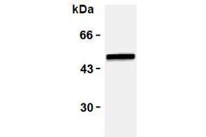 Western Blotting (WB) image for anti-Vimentin (VIM) antibody (ABIN1109484) (Vimentin Antikörper)