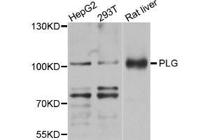 Western blot analysis of extracts of various cell lines, using PLG antibody (ABIN5971711) at 1/1000 dilution. (PLG Antikörper)