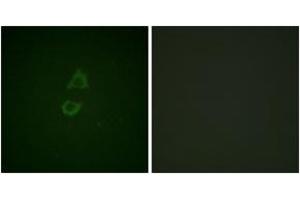Immunofluorescence analysis of A549 cells, using Vinculin (Ab-821) Antibody. (Vinculin Antikörper  (AA 786-835))