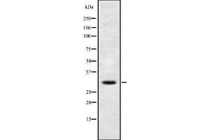 Western blot analysis of DIO3 using COS7 whole cell lysates (DIO3 Antikörper)