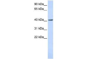 SMYD3 antibody used at 0. (SMYD3 Antikörper  (N-Term))