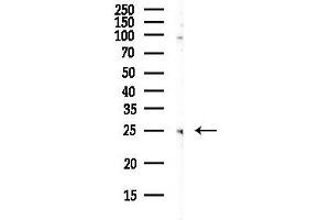 anti-Charged Multivesicular Body Protein 5 (CHMP5) antibody