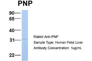 Host:  Rabbit  Target Name:  PNP  Sample Type:  Human Fetal Liver  Antibody Dilution:  1. (NP (Middle Region) Antikörper)