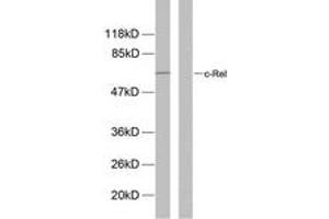 Western blot analysis of extracts from MDA-MB-435 cells, using Rel (Phospho-Ser503) Antibody.