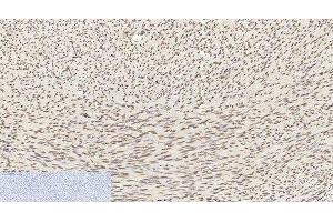 Immunohistochemistry of paraffin-embedded Human uterus tissue using Histone H3 Monoclonal Antibody at dilution of 1:200.