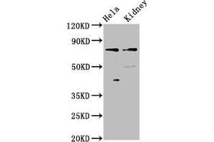 Western Blot Positive WB detected in: Hela whole cell lysate, Rat kidney tissue All lanes: CLCNKB antibody at 3 μg/mL Secondary Goat polyclonal to rabbit IgG at 1/50000 dilution Predicted band size: 76, 57 kDa Observed band size: 76 kDa (CLCNKB Antikörper  (AA 538-687))