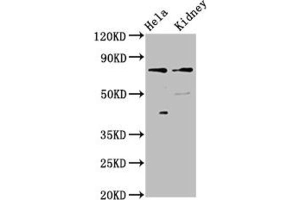 CLCNKB Antikörper  (AA 538-687)