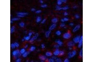 Immunofluorescence analysis of Human lung tissue using PPIB Monoclonal Antibody at dilution of 1:200. (PPIB Antikörper)