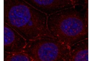 Immunofluorescence analysis of methanol-fixed MCF-7 cells using Phospho-IGF1R(Y1161) Polyclonal Antibody (IGF1R Antikörper  (pTyr1161))