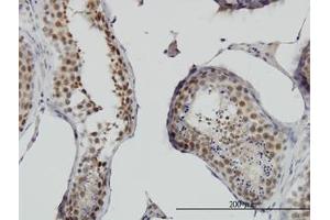Image no. 2 for anti-Ring Finger Protein 141 (RNF141) (AA 141-230) antibody (ABIN599236) (RNF141 Antikörper  (AA 141-230))