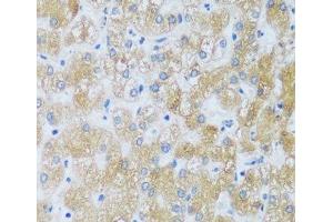 Immunohistochemistry of paraffin-embedded Human liver using ASB4 Polyclonal Antibody at dilution of 1:100 (40x lens). (ASB4 Antikörper)