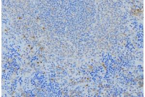 ABIN6276899 at 1/100 staining Human lymph node tissue by IHC-P.