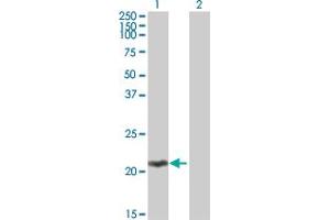 Western Blot analysis of MOBKL2C expression in transfected 293T cell line by MOBKL2C MaxPab polyclonal antibody. (MOBKL2C Antikörper  (AA 1-216))