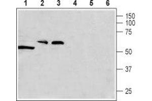 Western blot analysis of rat testis (lanes 1 and 4), rat brain (lanes 2 and 5) and mouse brain (lanes 3 and 6) lysates: - 1-3. (CACNG8 Antikörper  (Intracellular, N-Term))