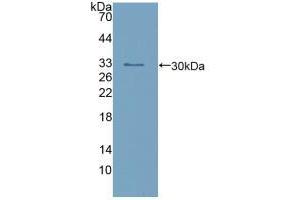 Western blot analysis of recombinant Human calretinin. (Calretinin Antikörper  (AA 28-248))
