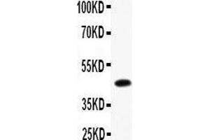 Western Blotting (WB) image for anti-B-cell antigen receptor complex-associated protein alpha chain (CD79A) (AA 121-226) antibody (ABIN3043397) (CD79a Antikörper  (AA 121-226))