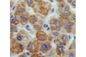 Used in DAB staining on fromalin fixed paraffin-embedded Liver tissue (MMP16 Antikörper  (AA 351-557))
