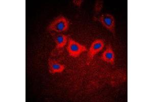 Immunofluorescent analysis of Cytokeratin 10 staining in A431 cells. (Keratin 10 Antikörper  (Center))