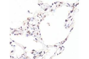 Immunohistochemistry (Paraffin-embedded Sections) (IHC (p)) image for anti-Myc Proto-Oncogene protein (MYC) (pSer62) antibody (ABIN7265076)