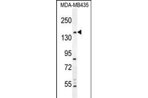 CS Antibody (N-term) 1271a western blot analysis in MDA-M cell line lysates (35 μg/lane). (CAMSAP1 Antikörper  (N-Term))