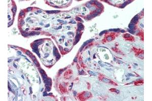 Placenta, Human: Formalin-Fixed, Paraffin-Embedded (FFPE) (PDIA4 Antikörper  (AA 623-638))