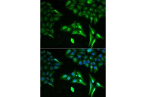 Immunofluorescence analysis of U20S cell using ACADS antibody. (ACADS Antikörper)