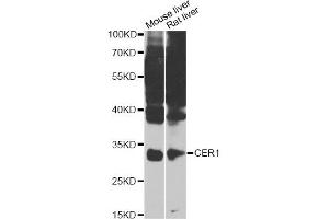Western blot analysis of extracts of various cell lines, using CER1 Antibody (ABIN4903254) at 1:1000 dilution. (CER1 Antikörper)