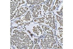IHC analysis of RTCB using anti-RTCB antibody (ABIN7600722).