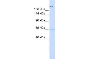 WB Suggested Anti-ATP10D Antibody Titration:  0. (ATP10D Antikörper  (C-Term))