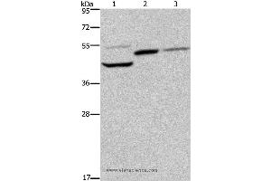 Western blot analysis of Mouse heart, kidney and liver tissue, using CYR61 Polyclonal Antibody at dilution of 1:350 (CYR61 Antikörper)