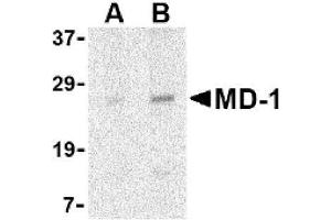Image no. 1 for anti-Lymphocyte Antigen 86 (LY86) (Middle Region) antibody (ABIN265132) (LY86 Antikörper  (Middle Region))