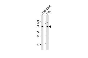 All lanes : Anti-TBB1 Antibody at 1:2000 dilution Lane 1: CCRF-CEM whole cell lysate Lane 2: Hela whole cell lysate Lysates/proteins at 20 μg per lane. (TUBB1 Antikörper)