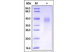 Mouse Dkk-1, His Tag on SDS-PAGE under reducing (R) condition. (DKK1 Protein (AA 32-272) (His tag))