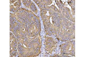 IHC analysis of MRPS22 using anti-MRPS22 antibody (ABIN7600613). (MRPS22 Antikörper  (AA 21-329))