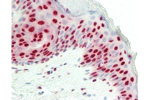 Anti-MATR3 / Matrin 3 antibody IHC staining of human skin. (MATR3 Antikörper  (C-Term))