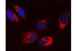 IF analysis of SRPRA using anti-SRPRA antibody (ABIN7601408). (SRPRA (AA 346-638) Antikörper)