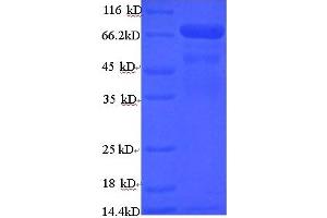 SDS-PAGE (SDS) image for TNF Receptor-Associated Factor 6 (TRAF6) (AA 1-522), (full length) protein (His-SUMO Tag) (ABIN5710550) (TRAF6 Protein (AA 1-522, full length) (His-SUMO Tag))