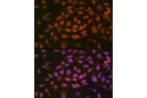 Immunofluorescence analysis of HeLa cells using GRK2 Rabbit mAb (ABIN7265504) at dilution of 1:100 (40x lens). (GRK2 Antikörper)