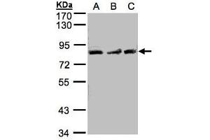 Image no. 1 for anti-MutL Homolog 1 (MLH1) (AA 373-735) antibody (ABIN467426) (MLH1 Antikörper  (AA 373-735))