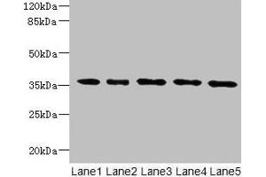 Western blot All lanes: OXNAD1 antibody at 4 μg/mL Lane 1: Mouse large intestine tissue Lane 2: Mouse lung tissue Lane 3: K562 whole cell lysate Lane 4: U251 whole cell lysate Lane 5: A549 whole cell lysate Secondary Goat polyclonal to rabbit IgG at 1/10000 dilution Predicted band size: 35 kDa Observed band size: 35 kDa (OXNAD1 Antikörper  (AA 18-312))