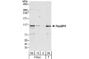 anti-Importin 8 (IPO8) (AA 987-1037) antibody