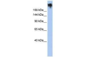 PKDREJ antibody used at 1 ug/ml to detect target protein. (PKDREJ Antikörper  (Middle Region))