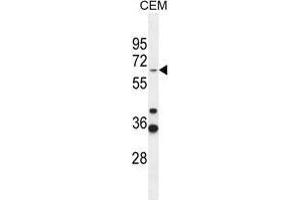 ZNF667 Antibody (Center) western blot analysis in CEM cell line lysates (35 µg/lane). (ZNF667 Antikörper  (Middle Region))