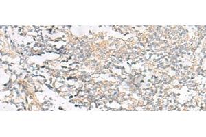 Immunohistochemistry of paraffin-embedded Human tonsil tissue using HELT Polyclonal Antibody at dilution of 1:40(x200) (HELT Antikörper)