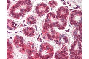 Anti-NUR77 antibody IHC of human breast.